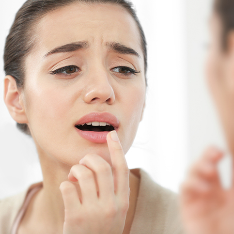 woman discovering canker sore